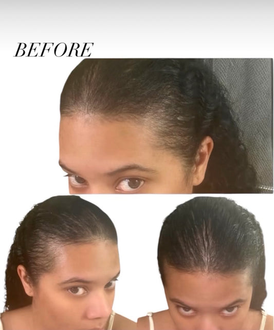 AHSEDON Beauty Hair Growth Essentials Bundle with Rosemary Oil and Flaxseed Gel